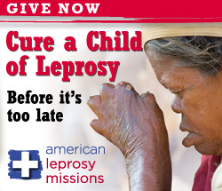 I want to help leprosy victims!